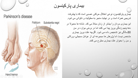 پاورپوینت اختلالات مغز در سالمندان